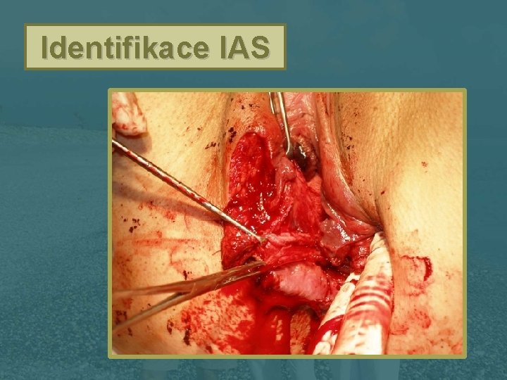 Identifikace IAS 