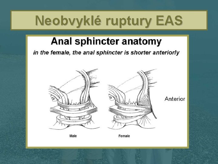 Neobvyklé ruptury EAS 