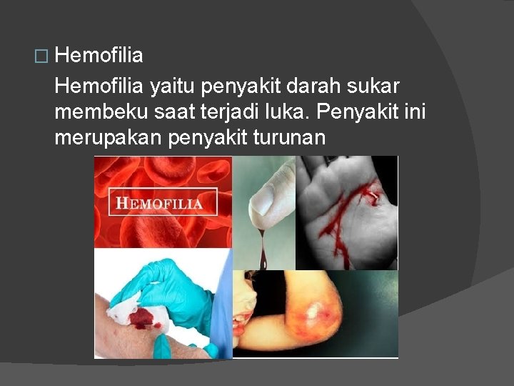 � Hemofilia yaitu penyakit darah sukar membeku saat terjadi luka. Penyakit ini merupakan penyakit � Hemofilia yaitu penyakit darah sukar membeku saat terjadi luka. Penyakit ini merupakan penyakit
