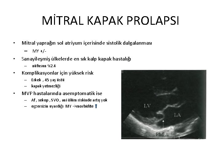 MİTRAL KAPAK PROLAPSI • • Mitral yaprağın sol atriyum içerisinde sistolik dalgalanması – MY