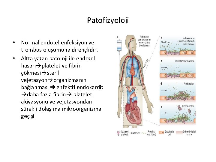 Patofizyoloji • Normal endotel enfeksiyon ve trombüs oluşumuna dirençlidir. • Altta yatan patoloji ile