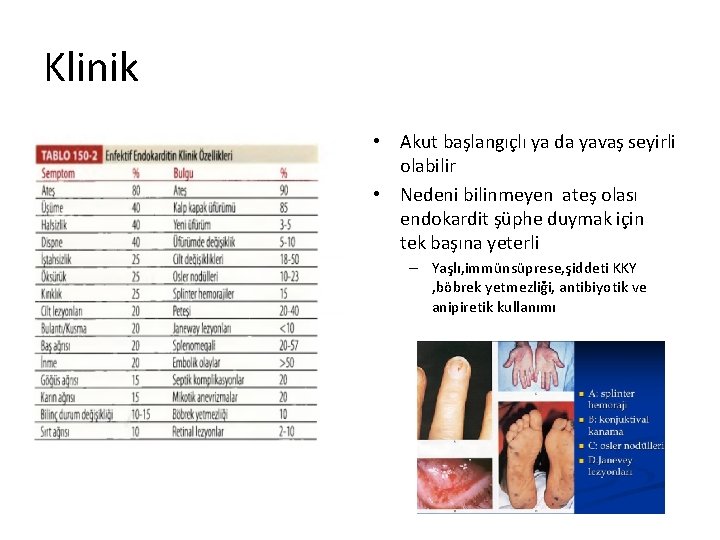 Klinik • Akut başlangıçlı ya da yavaş seyirli olabilir • Nedeni bilinmeyen ateş olası