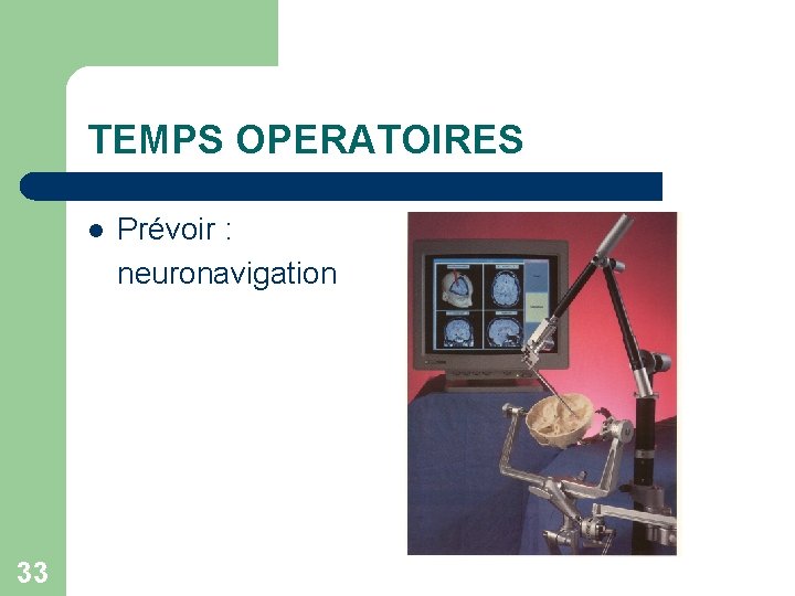 TEMPS OPERATOIRES l 33 Prévoir : neuronavigation 