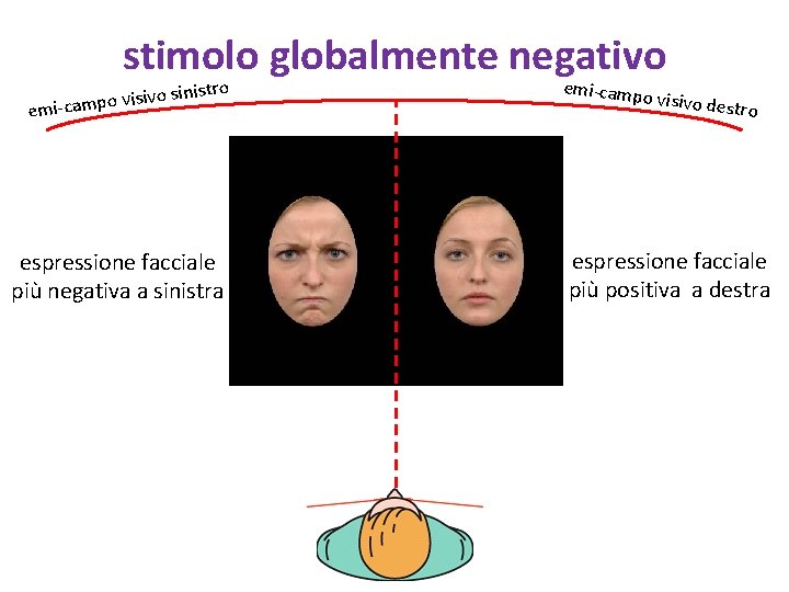 stimolo globalmente negativo sinistro o v i s i v o p emi-cam espressione