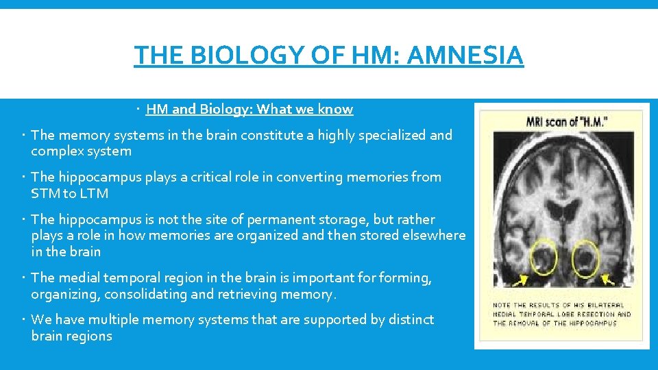 THE BIOLOGY OF HM: AMNESIA HM and Biology: What we know The memory systems