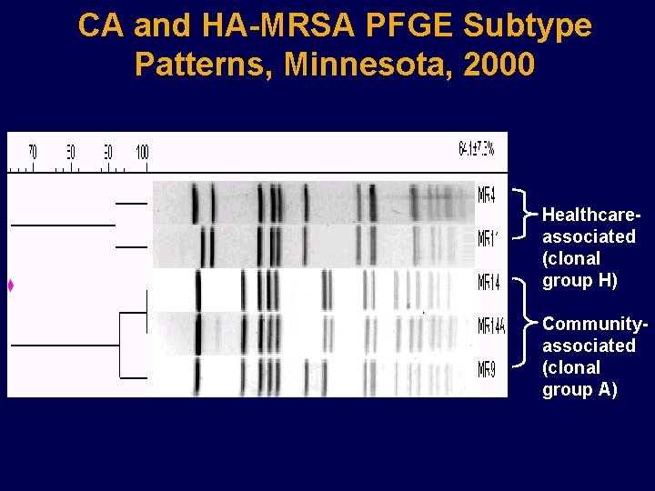 CA and HA-MRSA PFGE Subtype Patterns, Minnesota, 2000 Healthcareassociated (clonal group H) Communityassociated (clonal