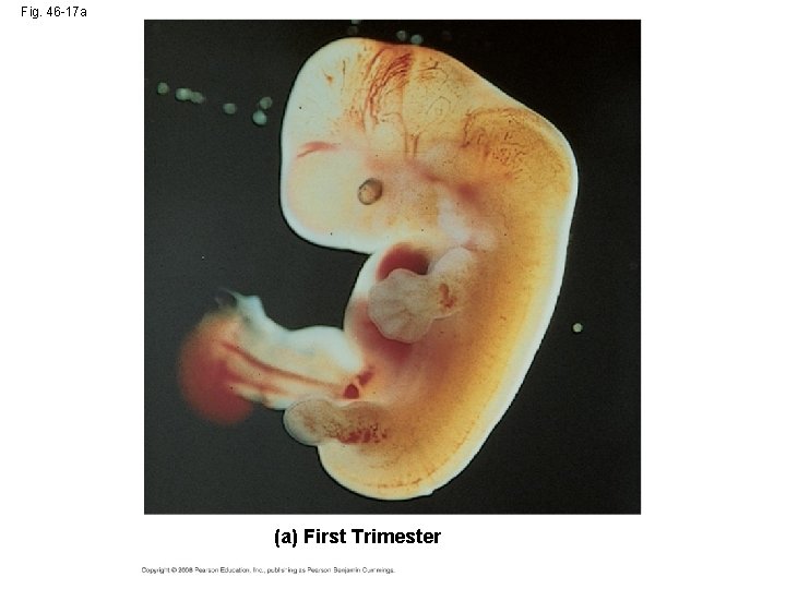 Fig. 46 -17 a (a) First Trimester 