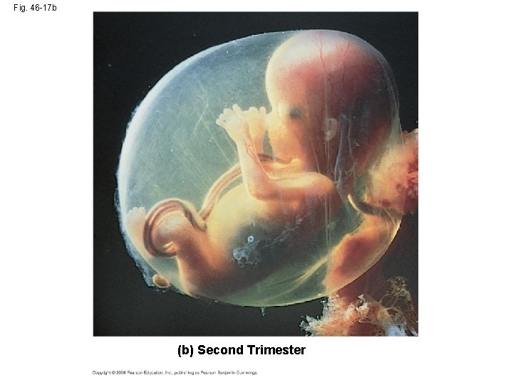 Fig. 46 -17 b (b) Second Trimester 