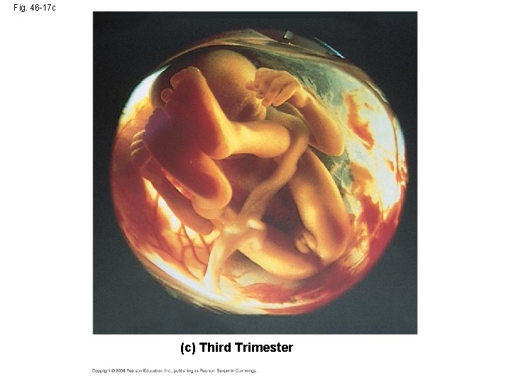 Fig. 46 -17 c (c) Third Trimester 