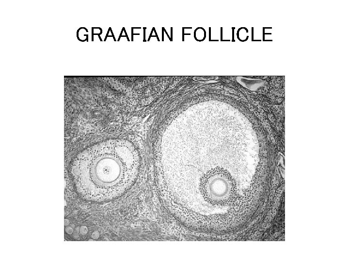 GRAAFIAN FOLLICLE 