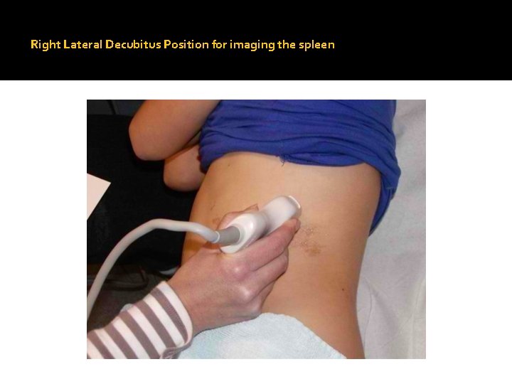 Right Lateral Decubitus Position for imaging the spleen 