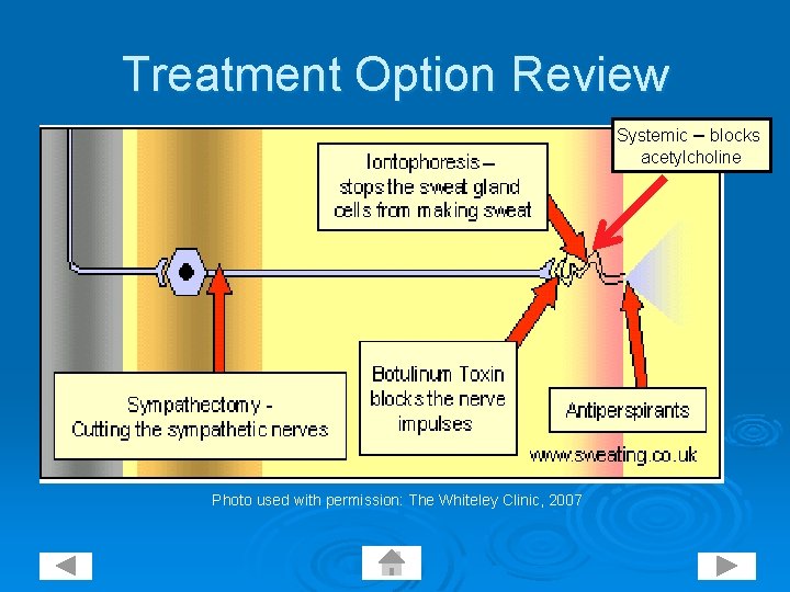 Treatment Option Review Systemic – blocks acetylcholine Photo used with permission: The Whiteley Clinic,
