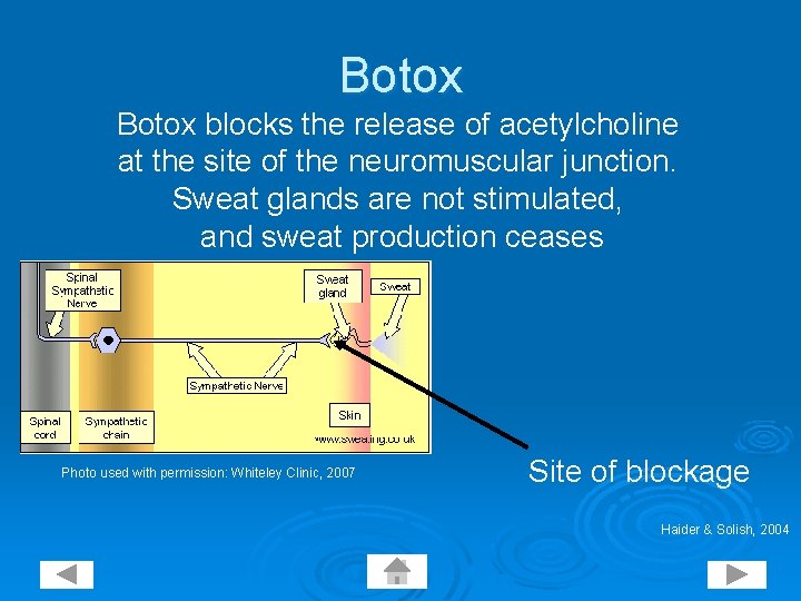 Botox blocks the release of acetylcholine at the site of the neuromuscular junction. Sweat