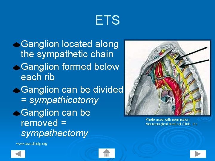 ETS Ganglion located along the sympathetic chain Ganglion formed below each rib Ganglion can