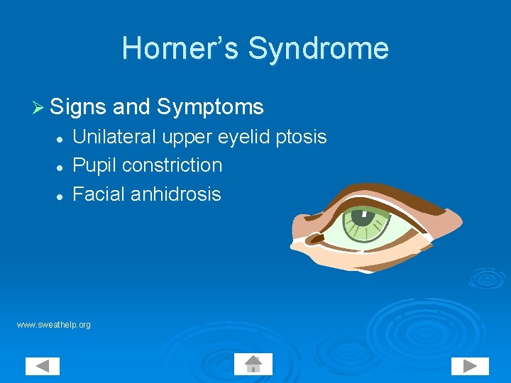 Horner’s Syndrome Ø Signs and Symptoms l l l Unilateral upper eyelid ptosis Pupil