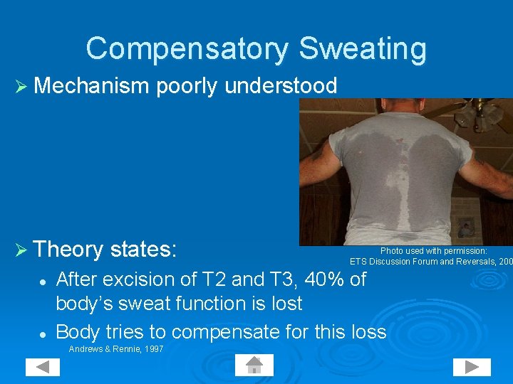 Compensatory Sweating Ø Mechanism poorly understood Ø Theory states: l l Photo used with