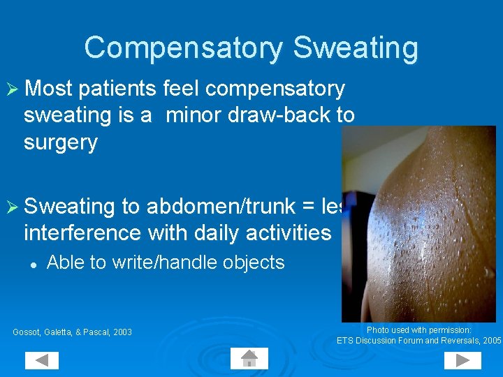 Compensatory Sweating Ø Most patients feel compensatory sweating is a minor draw-back to surgery