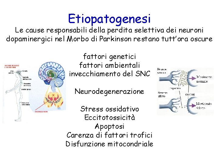 Etiopatogenesi Le cause responsabili della perdita selettiva dei neuroni dopaminergici nel Morbo di Parkinson Etiopatogenesi Le cause responsabili della perdita selettiva dei neuroni dopaminergici nel Morbo di Parkinson