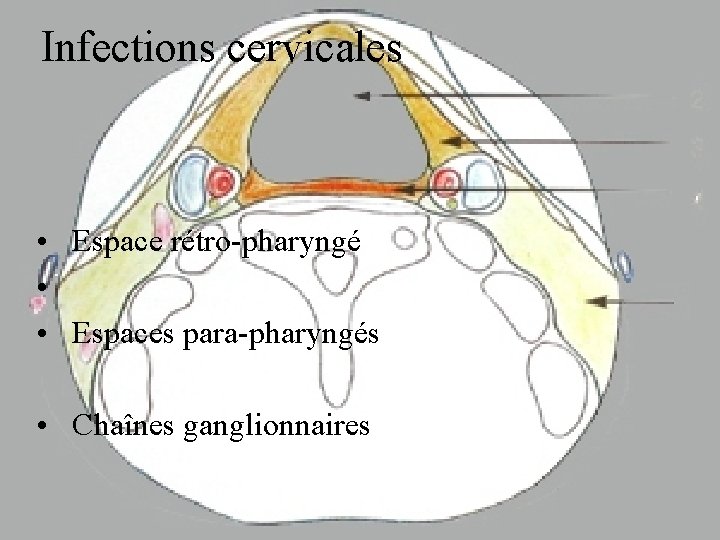 infections-de-la-sphre-orl-aux-urgences-complications