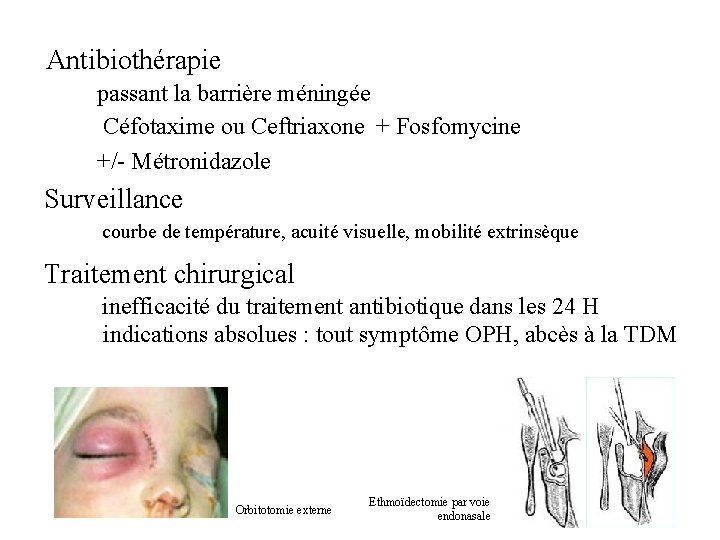  Antibiothérapie passant la barrière méningée Céfotaxime ou Ceftriaxone + Fosfomycine +/- Métronidazole Surveillance