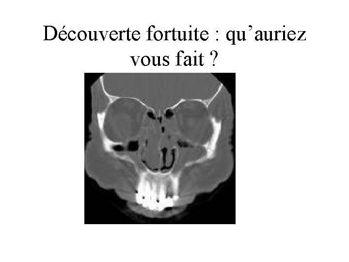 Découverte fortuite : qu’auriez vous fait ? 