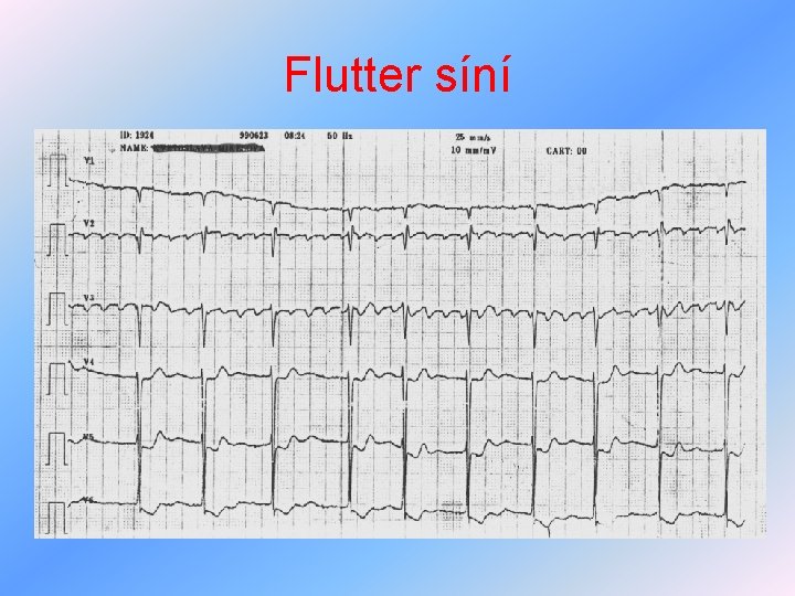 Flutter síní 