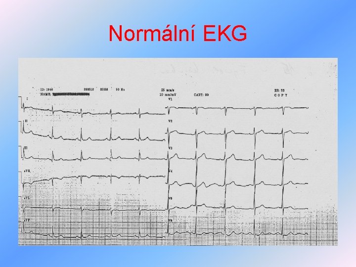 Normální EKG 