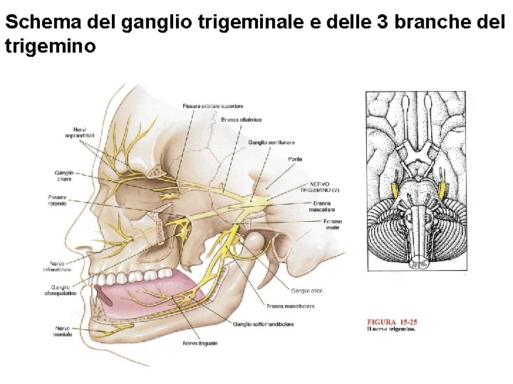 Schema del ganglio trigeminale e delle 3 branche del trigemino 