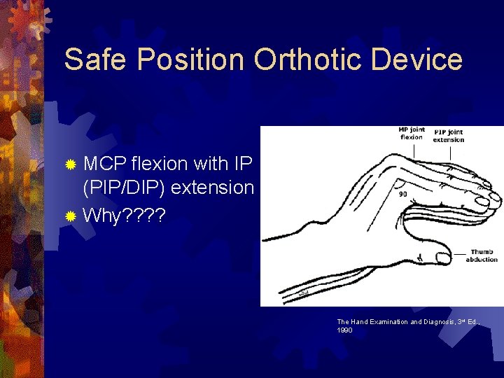 Safe Position Orthotic Device ® MCP flexion with IP (PIP/DIP) extension ® Why? ? Safe Position Orthotic Device ® MCP flexion with IP (PIP/DIP) extension ® Why? ?
