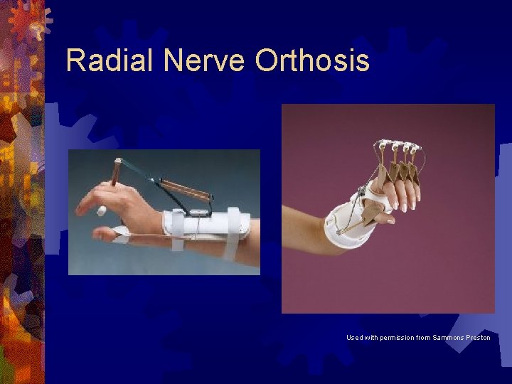 Radial Nerve Orthosis Used with permission from Sammons Preston Radial Nerve Orthosis Used with permission from Sammons Preston