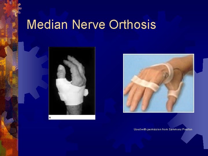 Median Nerve Orthosis Used with permission from Sammons Preston Median Nerve Orthosis Used with permission from Sammons Preston