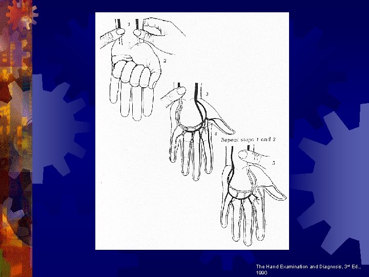 The Hand Examination and Diagnosis, 3 rd Ed. , 1990 The Hand Examination and Diagnosis, 3 rd Ed. , 1990