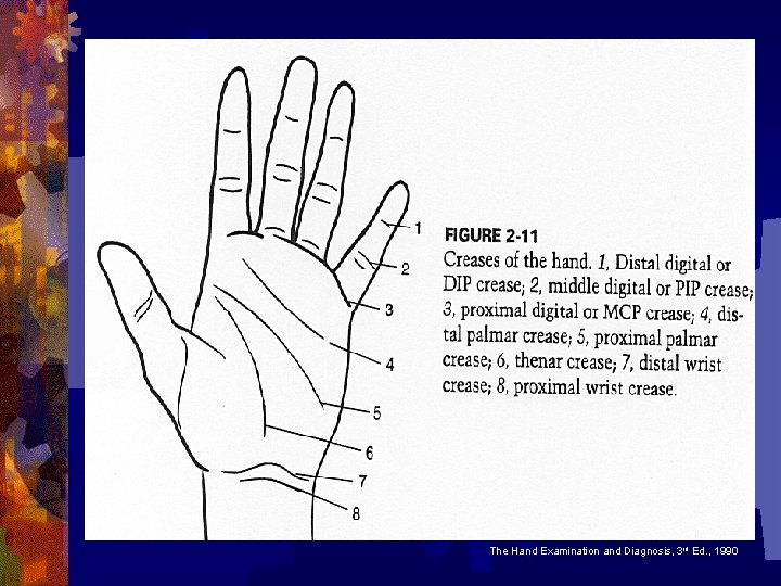 The Hand Examination and Diagnosis, 3 rd Ed. , 1990 The Hand Examination and Diagnosis, 3 rd Ed. , 1990