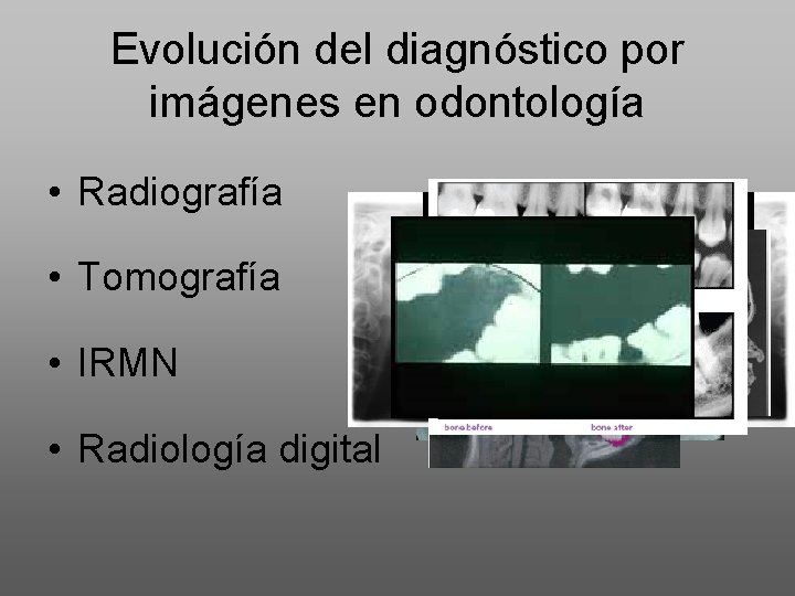 Evolución del diagnóstico por imágenes en odontología • Radiografía • Tomografía • IRMN •