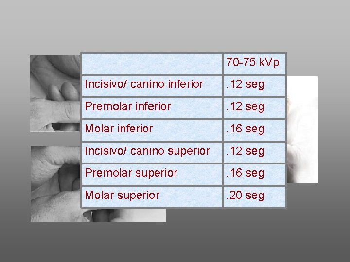 70 -75 k. Vp Incisivo/ canino inferior . 12 seg Premolar inferior . 12