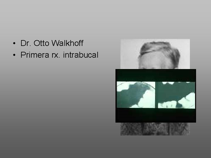  • Dr. Otto Walkhoff • Primera rx. intrabucal 