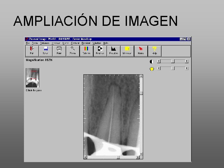 AMPLIACIÓN DE IMAGEN 