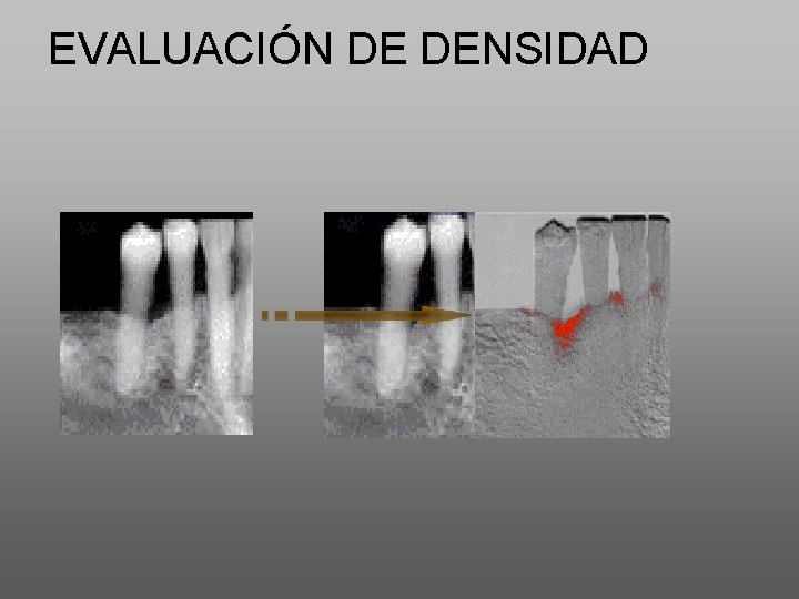 EVALUACIÓN DE DENSIDAD 