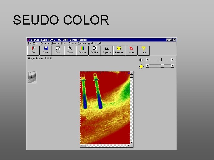 SEUDO COLOR 