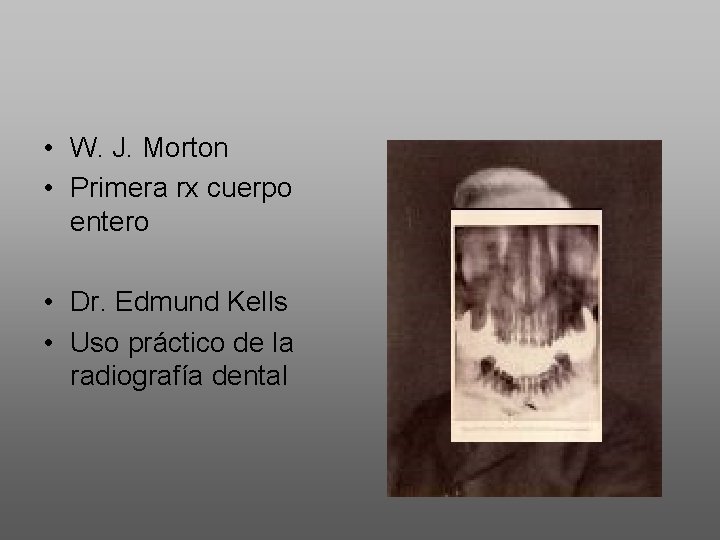  • W. J. Morton • Primera rx cuerpo entero • Dr. Edmund Kells