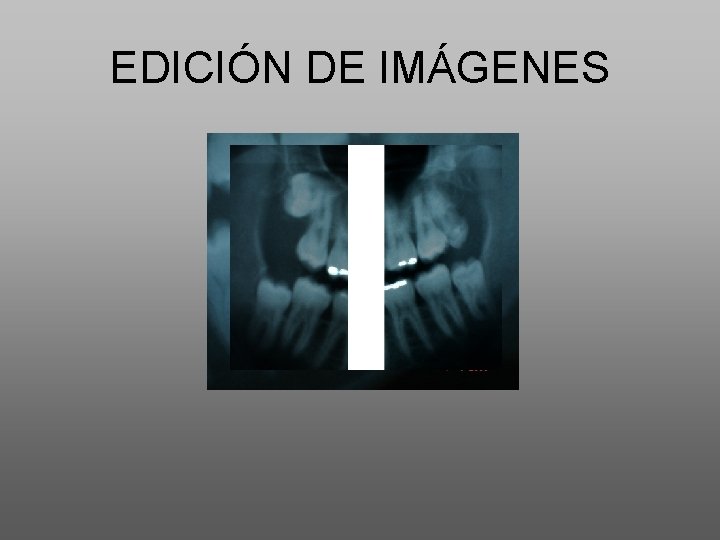 EDICIÓN DE IMÁGENES 