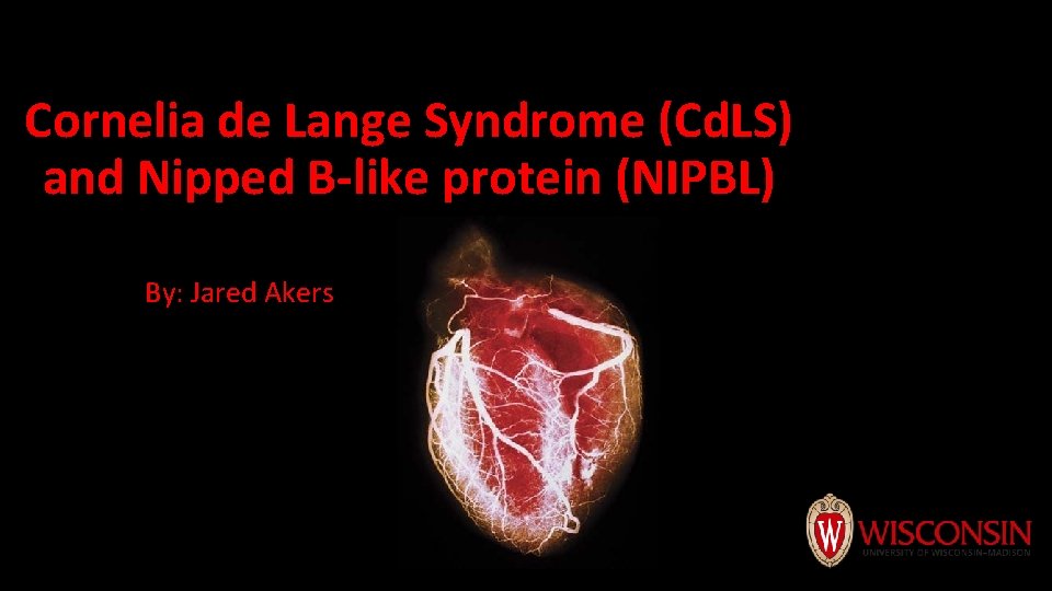 Cornelia de Lange Syndrome (Cd. LS) and Nipped B-like protein (NIPBL) By: Jared Akers Cornelia de Lange Syndrome (Cd. LS) and Nipped B-like protein (NIPBL) By: Jared Akers
