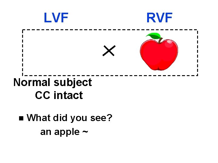 LVF Normal subject CC intact n What did you see? an apple ~ RVF