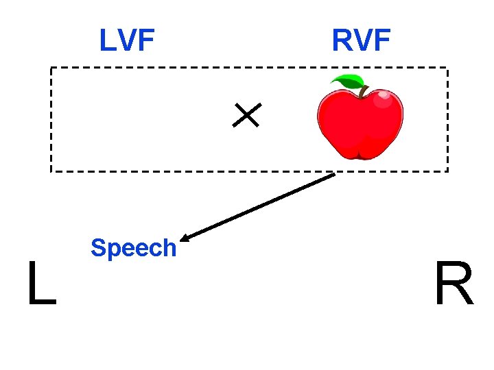 LVF L Speech RVF R 