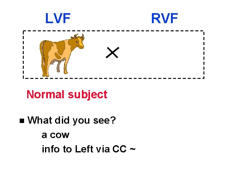 LVF Normal subject n What did you see? a cow info to Left via