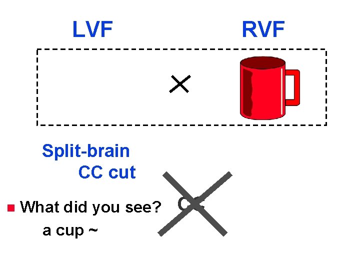 LVF RVF Split-brain CC cut n What did you see? a cup ~ CC