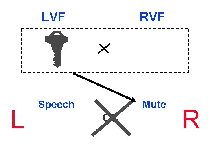 L LVF RVF Speech Mute CC R 