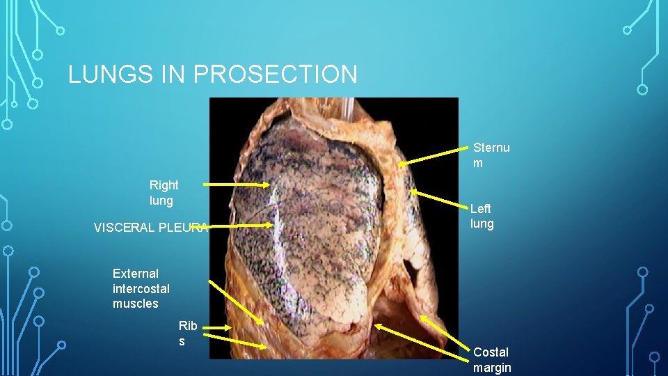 LUNGS IN PROSECTION Sternu m Right lung VISCERAL PLEURA Left lung External intercostal muscles
