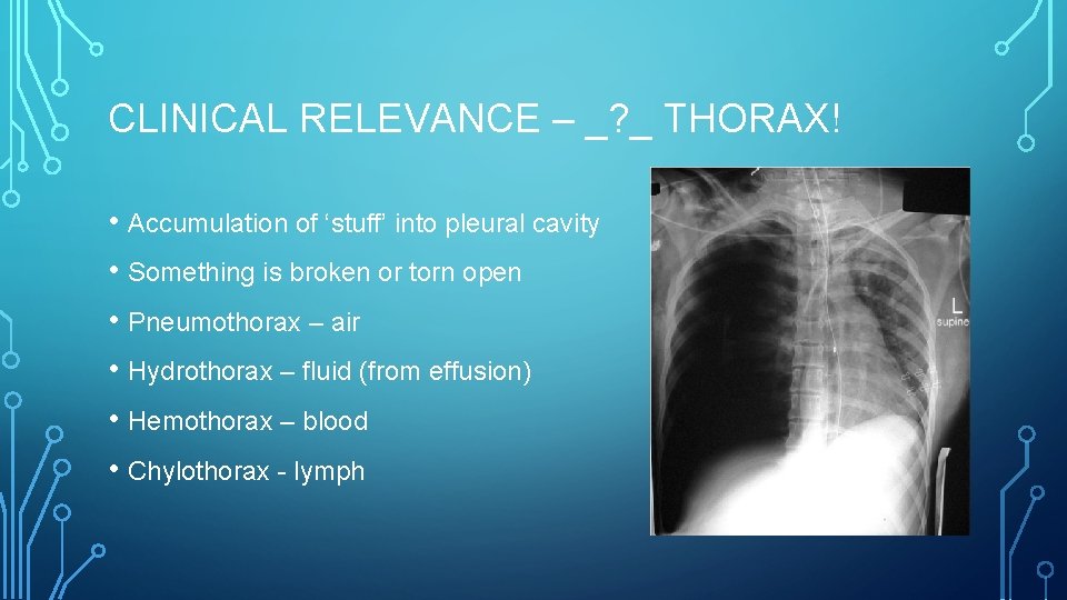 CLINICAL RELEVANCE – _? _ THORAX! • Accumulation of ‘stuff’ into pleural cavity •