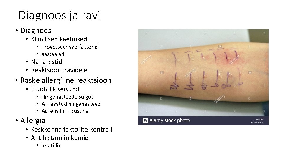 Diagnoos ja ravi • Diagnoos • Kliinilised kaebused • Provotseerivad faktorid • aastaajad •